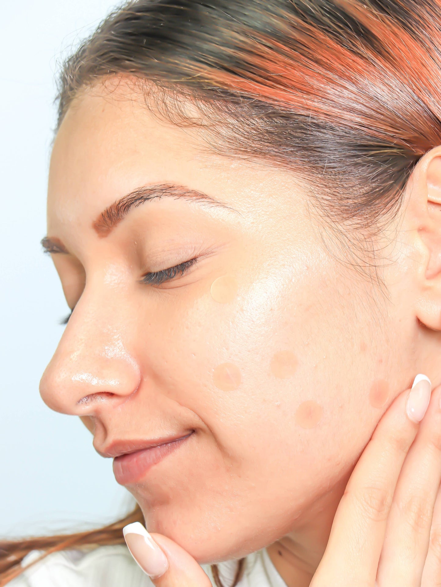 Skin Tint Hydrocolloid Pimple Patches